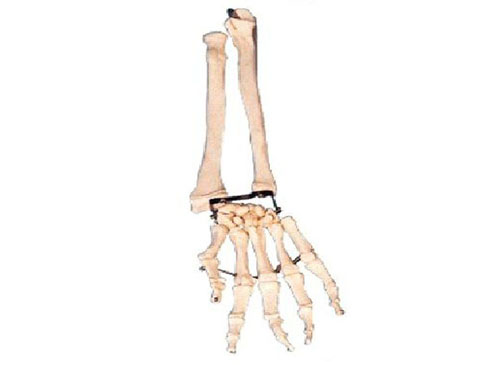 ZRJP-121A手掌骨带尺骨和桡骨模型